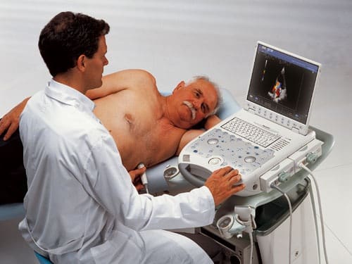 Affordable Echocardiogram in North Miami